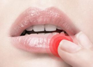 Herpesz – az ellenség! Nekem mi vált be? herpesz