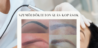 Szemöldöktetoválás kopásai szemöldöktetoválás kopásai