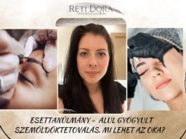 Esettanulmány – Miért gyógyulhat alul a szemöldöktetoválás, azaz miért lehet halvány? szemöldöktetoválás _ esettanulmány