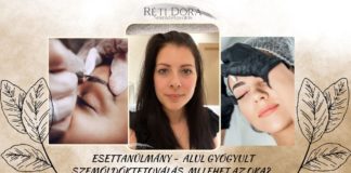 Esettanulmány – Miért gyógyulhat alul a szemöldöktetoválás, azaz miért lehet halvány? szemöldöktetoválás _ esettanulmány