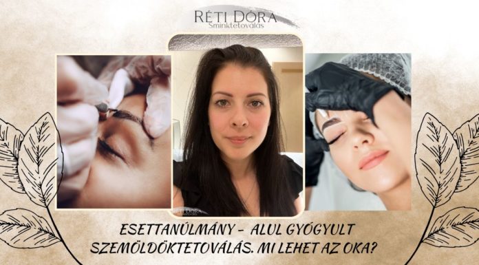 Esettanulmány – Miért gyógyulhat alul a szemöldöktetoválás, azaz miért lehet halvány? szemöldöktetoválás _ esettanulmány
